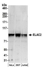 ELAC2 Antibody in Western Blot (WB)