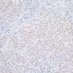 ELAC2 Antibody in Immunohistochemistry (Paraffin) (IHC (P))