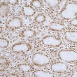 ELAC2 Antibody in Immunohistochemistry (Paraffin) (IHC (P))