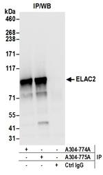 ELAC2 Antibody in Immunoprecipitation (IP)