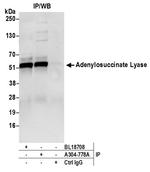 Adenylosuccinate Lyase/ADSL Antibody in Immunoprecipitation (IP)