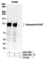 Calpastatin/CAST Antibody in Immunoprecipitation (IP)