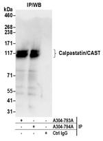 Calpastatin/CAST Antibody in Immunoprecipitation (IP)