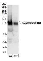 Calpastatin/CAST Antibody in Western Blot (WB)