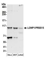 LONP1/PRSS15 Antibody in Western Blot (WB)