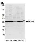 VPS26A Antibody in Western Blot (WB)