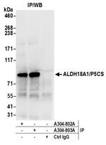 ALDH18A1/P5CS Antibody in Immunoprecipitation (IP)