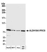 ALDH18A1/P5CS Antibody in Western Blot (WB)