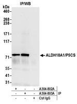 ALDH18A1/P5CS Antibody in Immunoprecipitation (IP)