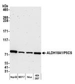 ALDH18A1/P5CS Antibody in Western Blot (WB)