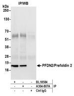 PFDN2/Prefoldin 2 Antibody in Immunoprecipitation (IP)