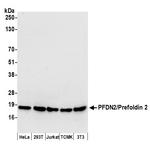 PFDN2/Prefoldin 2 Antibody in Western Blot (WB)