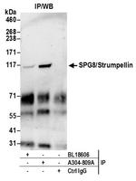 SPG8/Strumpellin Antibody in Immunoprecipitation (IP)