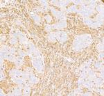 ARHGDIB/D4-GDI/RhoGDI2 Antibody in Immunohistochemistry (Paraffin) (IHC (P))