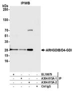 ARHGDIB/D4-GDI/RhoGDI2 Antibody in Immunoprecipitation (IP)