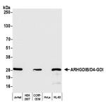 ARHGDIB/D4-GDI/RhoGDI2 Antibody in Western Blot (WB)