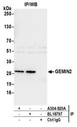 GEMIN2 Antibody in Immunoprecipitation (IP)