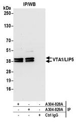 VTA1/LIP5 Antibody in Immunoprecipitation (IP)