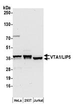 VTA1/LIP5 Antibody in Western Blot (WB)