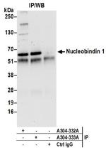 Nucleobindin 1/NUCB1 Antibody in Immunoprecipitation (IP)