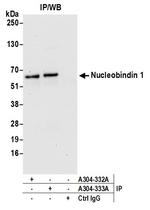 Nucleobindin 1/NUCB1 Antibody in Immunoprecipitation (IP)