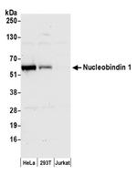 Nucleobindin 1/NUCB1 Antibody in Western Blot (WB)