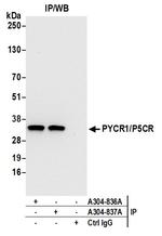 PYCR1/P5CR Antibody in Immunoprecipitation (IP)