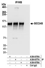 SEC24B Antibody in Immunoprecipitation (IP)