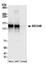 SEC24B Antibody in Western Blot (WB)