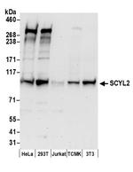 SCYL2 Antibody in Western Blot (WB)