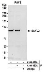 SCYL2 Antibody in Immunoprecipitation (IP)