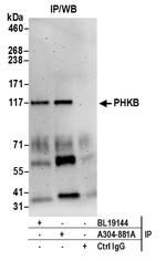 PHKB Antibody in Immunoprecipitation (IP)