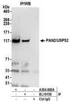 PAN2/USP52 Antibody in Immunoprecipitation (IP)