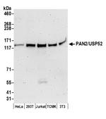 PAN2/USP52 Antibody in Western Blot (WB)