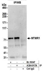 MTMR1 Antibody in Immunoprecipitation (IP)