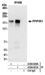 PPIP5K1/HISPPD2A Antibody in Immunoprecipitation (IP)