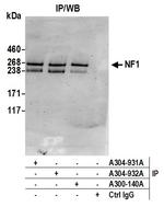 NF1 Antibody in Immunoprecipitation (IP)