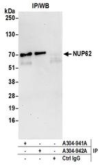 Nucleoporin p62/NUP62 Antibody in Immunoprecipitation (IP)