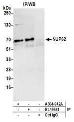 Nucleoporin p62/NUP62 Antibody in Immunoprecipitation (IP)