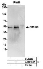 CDC123/C10orf7 Antibody in Immunoprecipitation (IP)