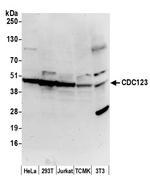 CDC123/C10orf7 Antibody in Western Blot (WB)