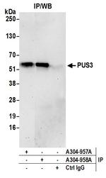 PUS3 Antibody in Immunoprecipitation (IP)