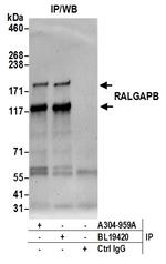 RALGAPB Antibody in Immunoprecipitation (IP)