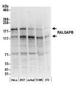 RALGAPB Antibody in Western Blot (WB)