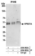 VPS37A Antibody in Immunoprecipitation (IP)