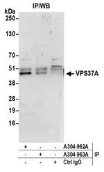 VPS37A Antibody in Immunoprecipitation (IP)