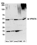 VPS37A Antibody in Western Blot (WB)