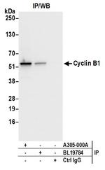 Cyclin B1/CCNB1 Antibody in Immunoprecipitation (IP)