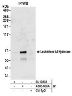 Leukotriene A4 Hydrolase/LTA4H Antibody in Immunoprecipitation (IP)