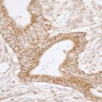 TRAP1/HSP75 Antibody in Immunohistochemistry (Paraffin) (IHC (P))